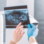 3 tipuri de radiografii dentare și când ai nevoie de fiecare