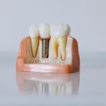 Cât de dureros este un implant dentar? Factori de risc vs. avantaje